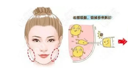 贵州利美康整形医院是私立医院吗?医院基本信息公布了