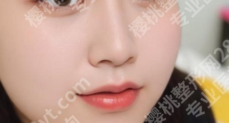 九院整形医院鼻综合的技术如何?哪位医生做的好?案例参考