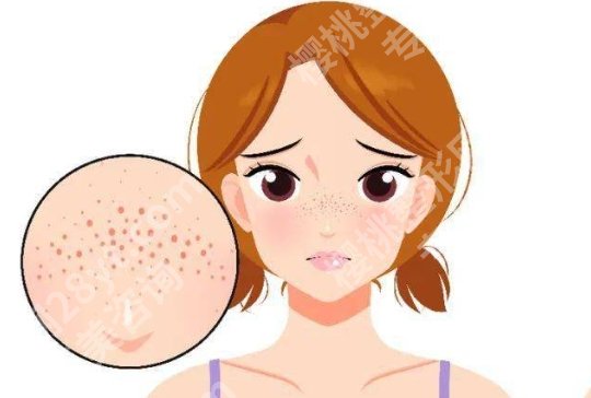 南方医科大学皮肤病医院激光美肤中心正规吗?医院的技术优势是什么?