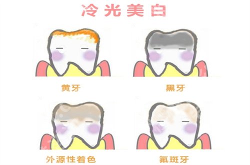 北京枫景口腔医院种植牙咋样?点评技术与案例