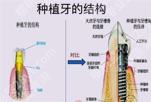 北京美呀植联门诊部怎么样?案例公布啦