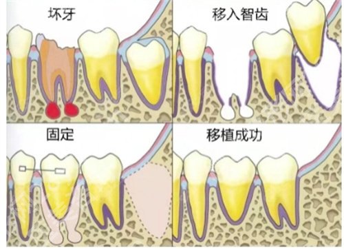北京冠美口腔医院种植牙专家怎么样?价格表公布,特色项目介绍