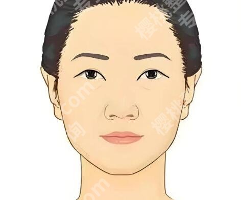 王仁根医生面部填充怎么样?热门医生资料更新-含相关案例过程