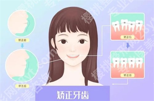 西尔口腔怎么样贵吗?价格带你了解起来