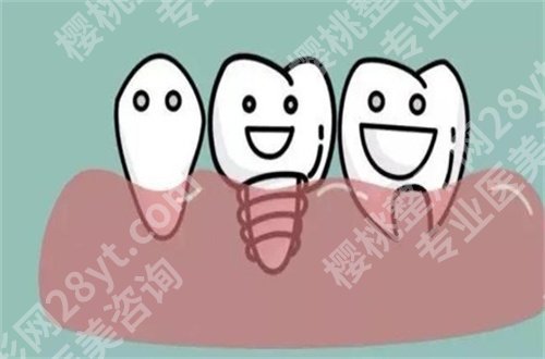 北大口腔医院种牙哪个大夫好?特色项目带你全面了解