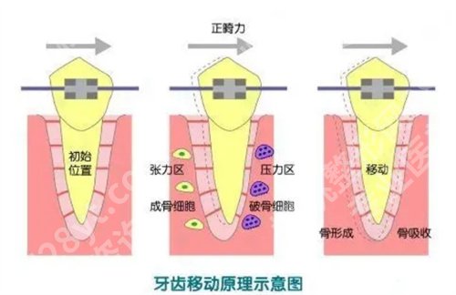 北京佳美口腔医院牙齿矫正价格是多少?看医院详细介绍