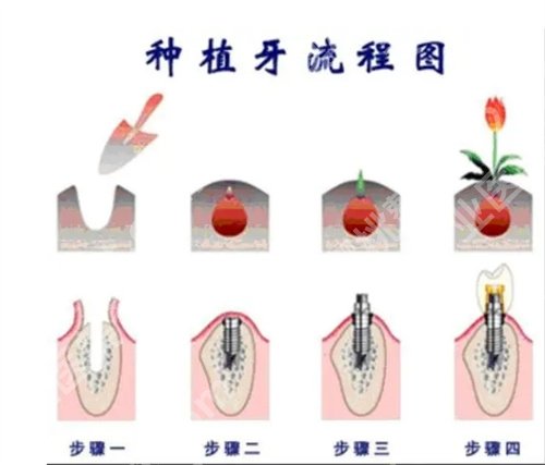 北京佳美口腔医院牙齿矫正价格是多少?看医院详细介绍