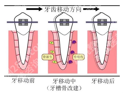 北京佳美口腔医院牙齿矫正价格是多少?看医院详细介绍