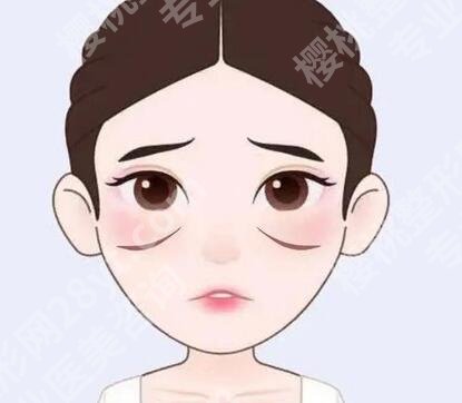 深圳美莱做眼袋手术好的医生有哪些?盘点人气医生名单和特色项目介绍