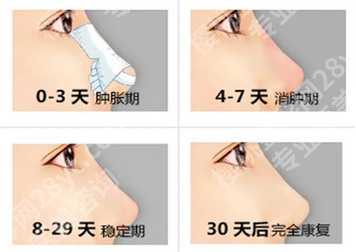 深圳美莱做鼻子谁好?分享热门医生资料-人气案例分享