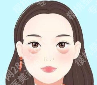陈贵宗做眼袋效果怎么样?了解医生资料,揭晓网友反馈一览