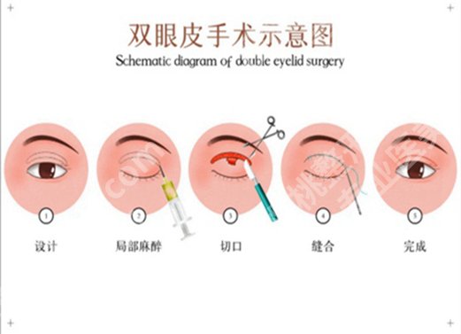 北京朝阳医院整形外科价格是多少?优选费用标准一览