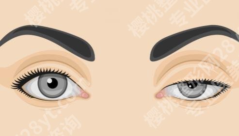 广州海峡医疗美容医院做双眼皮怎么样?揭晓看看医院信息-含医生团队