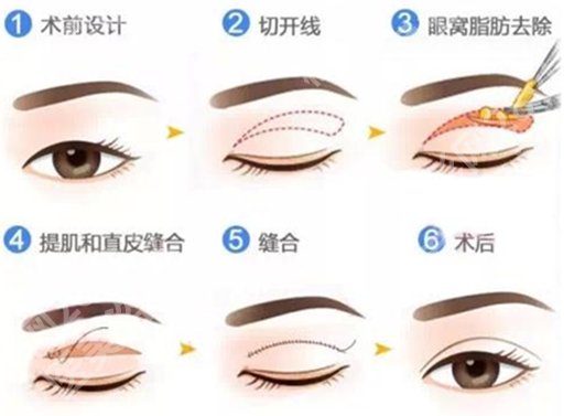 杭州十佳整形医院排名有哪些?公布热门医院信息,建议收藏