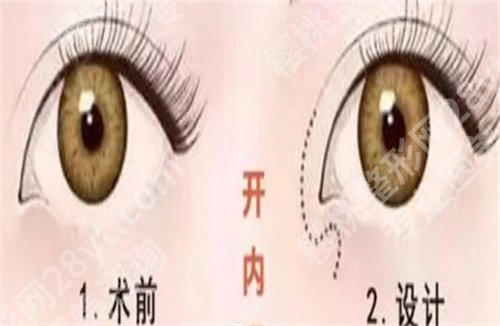 北京华韩医疗美容假体隆胸多少钱?医院实力曝光