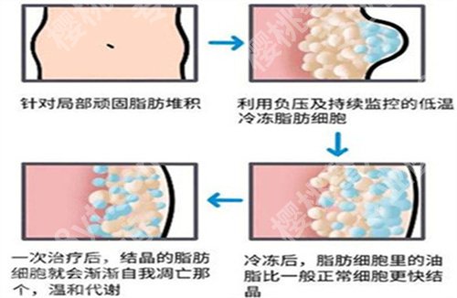 上海美之源整形门诊部做鼻子多少钱?2024价格表在线看
