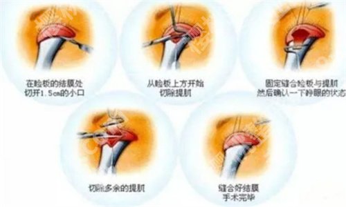 杭州艺星做眼袋哪个医生好?看医院详情介绍