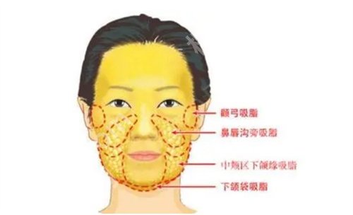 兰州皙妍丽整形好不好?看收费明细、特色项目