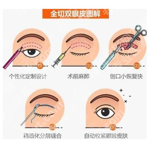 兰州皙妍丽整形好不好?看收费明细、特色项目