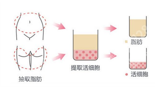 上海俏佳人医疗美容评价怎么样?经典项目告知了