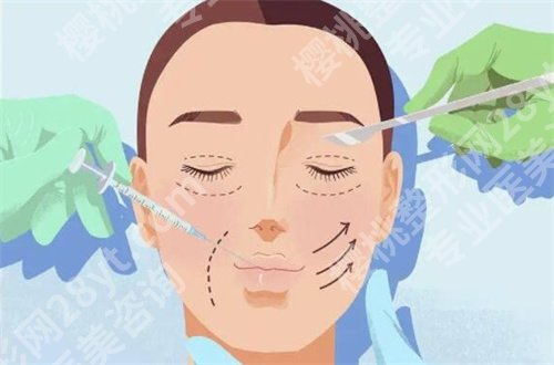 北京煤医怎么样?热门双眼皮项目案例展示,一起看详情