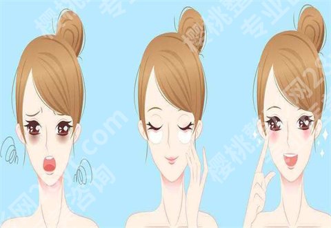 北京艺星去眼袋多少钱?热门案例公布,看术后反馈