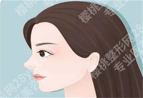 北京柏丽做鼻子好吗?真实案例反馈+价格表
