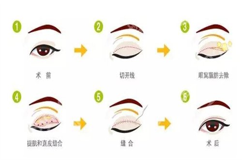北京八大处整形医院隆鼻多少钱?收费明细揭示,看介绍
