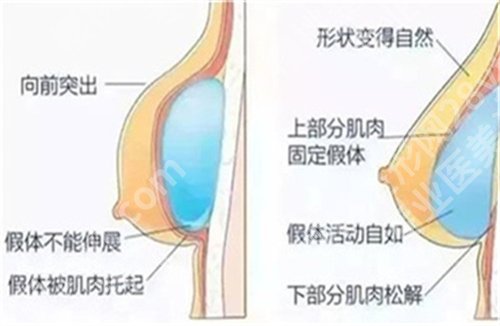 栾杰医生缩胸的手术收费怎么样?医生实力介绍