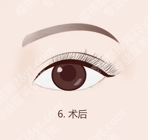 长春张连波双眼皮怎么样?具备多样审美基础研究的医生
