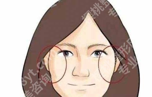 石家庄张雪梅注射玻尿酸怎么样?拥有很丰富的临床操作