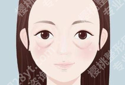 张学雷医生与闫国剑医生谁做眼袋加框隔释放比较好?查看两位医生资料一览