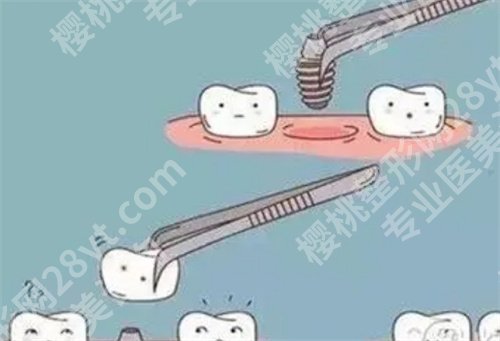 苏北医院种植牙收费标准怎么样?口碑点评