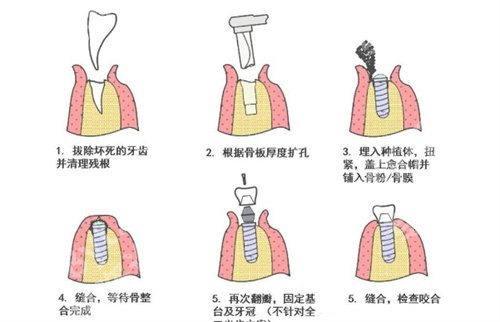 宁大附属医院口腔科怎么样?医院详情介绍,核心项目