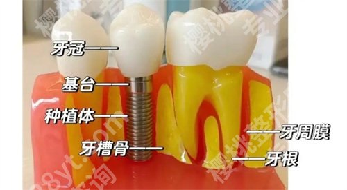 徐州中心医院牙科收费标准吗?看医院技术亮点