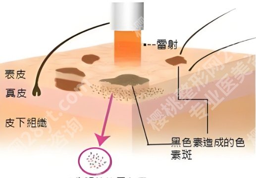扬州苏北医院祛斑挂什么科?含科室资料,分享主打项目介绍