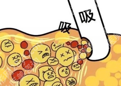 常州第一人民医院抽脂怎么样?热门项目介绍,口碑点评精选