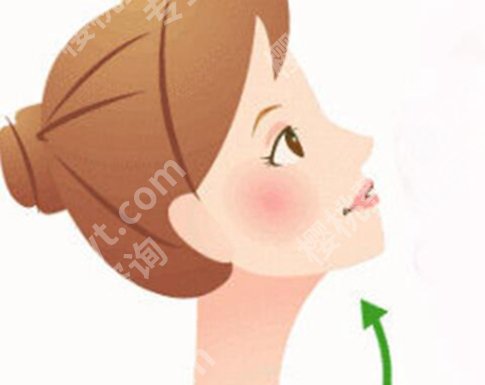 上海管果医生人中失败案例怎么样?详细案例,一起来看看吧