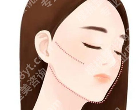 上海何晋龙磨骨怎么样?分享技术实力点评来了