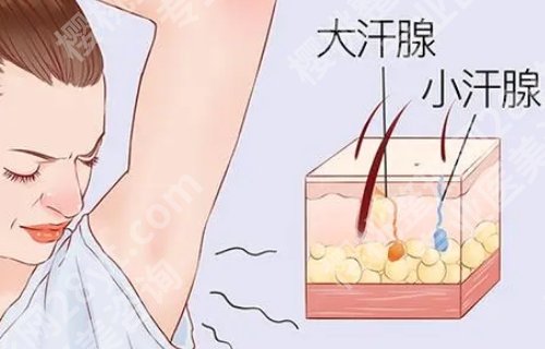 芜湖二院整形科去狐臭怎么样?科普信息介绍