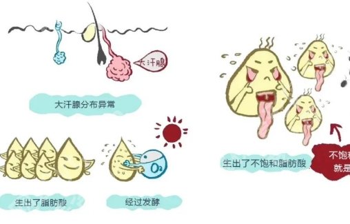 芜湖二院整形科去狐臭怎么样?科普信息介绍