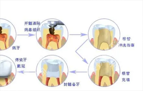 兰大二院种植牙怎么样?主打项目曝光,医院实力查看
