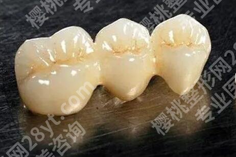上海新华医院种牙收费标准是什么?种牙费用详情发布-含医院信息查看