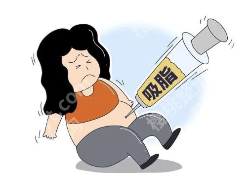 成都米兰柏羽吸脂怎么样?内附医院信息及项目介绍!