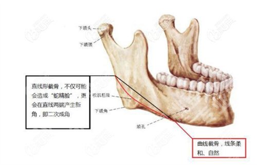 上海第八人民医院磨骨多少钱?看主打项目介绍