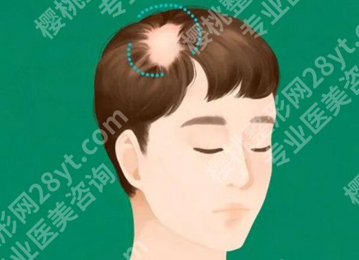 江门中心医院植发怎么样?医院基本信息介绍和顾客点评了解