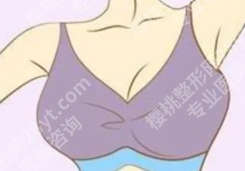 张东旭医生做胸怎么样?医生详细介绍与口碑点评