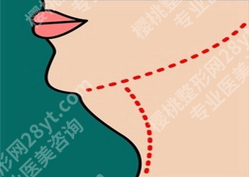 上海九院于洪波怎么样?公布医生信息和擅长项目资料分享