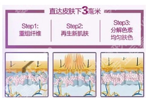 广东省第二人民医院激光整容科怎么样?看近期顾客点评