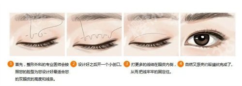 金华中心医院割双眼皮价格是多少?看医院新定价标准